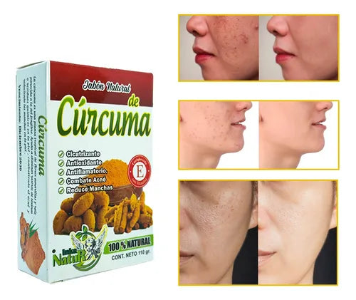 TRIO - 2 BALSAMO DE SEBO DE RES + 1 JABÓN CÚRCUMA